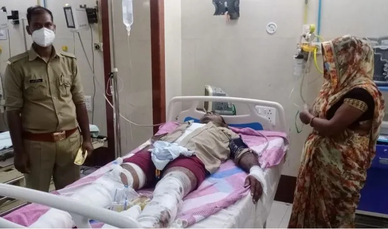 अयोध्या: बीईओ परीक्षा ड्यूटी को जा रहा दरोगा हादसे का शिकार, लखनऊ रेफर