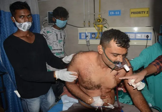 मुरादाबाद: मॉर्निंग वॉक पर निकले किसान को मारी गोली, अस्पताल में भर्ती