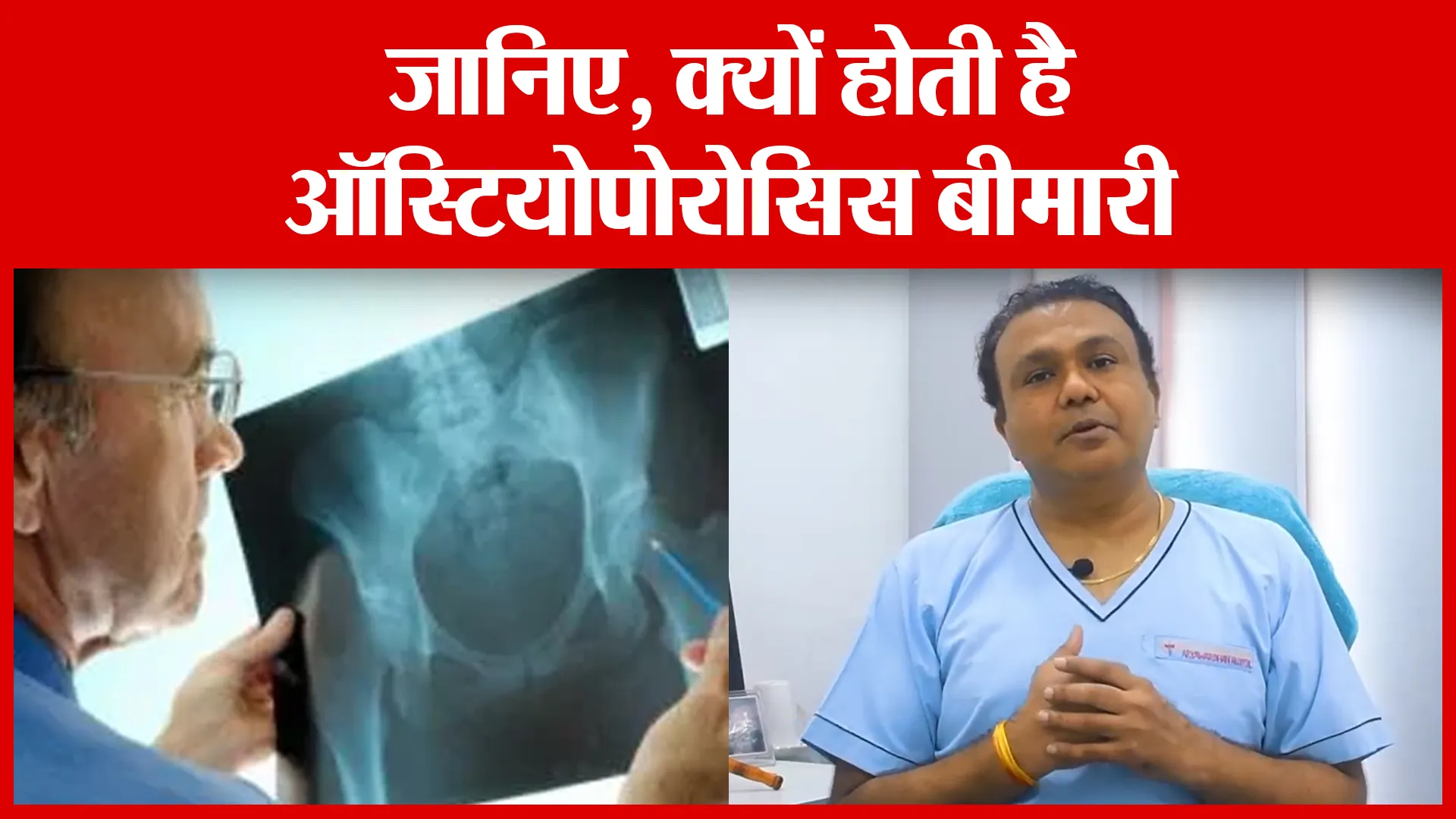 जानिए, क्यों होती है ऑस्टियोपोरोसिस बीमारी | Amritvichar