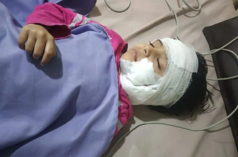 बरेली: विश्वविद्यालय कैंपस में बच्ची को कुत्तों ने नोचा, आईसीयू में भर्ती