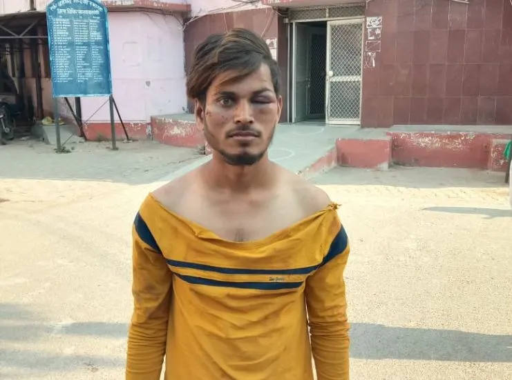 बाराबंकी: घर से खींचकर दबंगों ने किया जानलेवा हमला