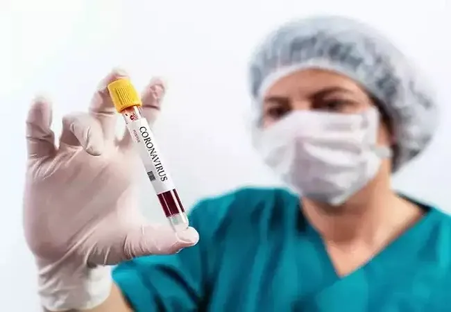 इटली में कोविड-19 के लिए टीकाकरण की प्रक्रिया जनवरी में आरंभ होगी