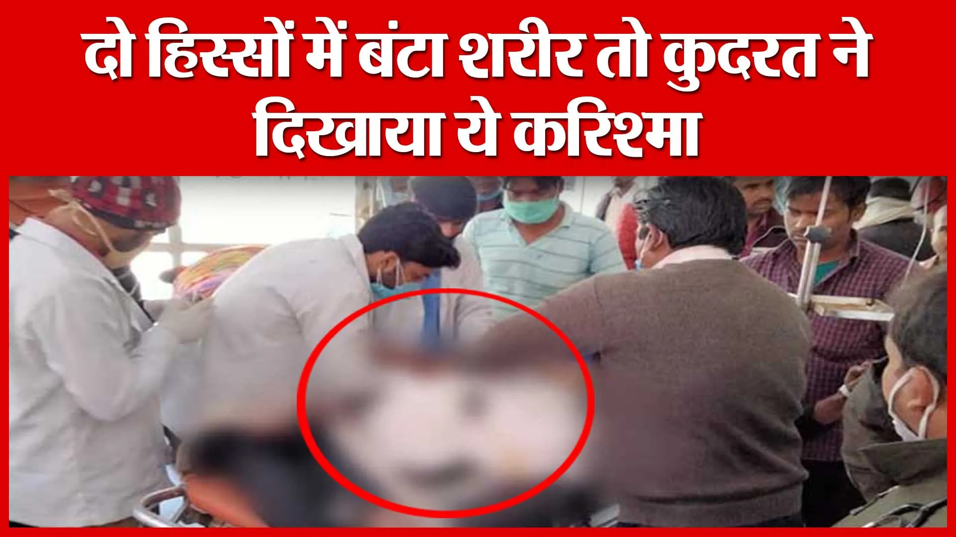 Shahjahanpur: दो हिस्सों में बंटा शरीर तो कुदरत ने दिखाया ये करिश्मा | Amritvichar