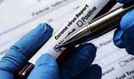 हल्द्वानी: अब नही होगी कोविड रिपोर्ट में देरी, एक और निजी लेब चिन्हित