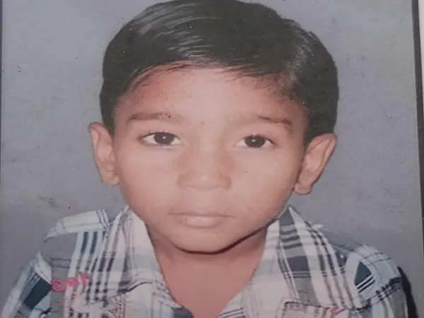 अमरोहा: आवारा कुत्तों ने बच्चे पर बोला हमला, मौत