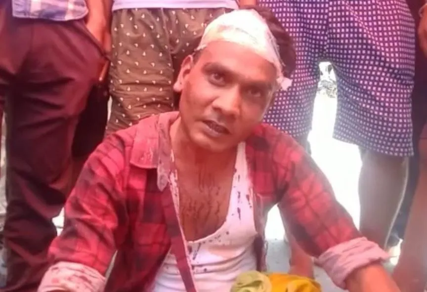 अयोध्या: निवर्तमान जिला पंचायत सदस्य पर हमला, समर्थकों ने किया प्रदर्शन