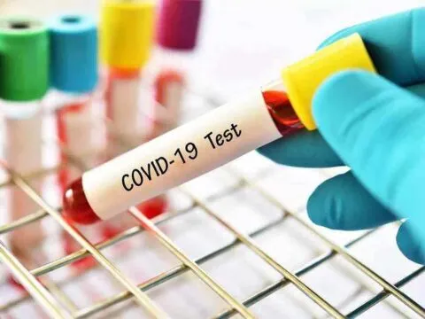 हल्द्वानी: कलेक्शन सेंटर ने मरीज के कोरोना सैंपल लेकर जांच को भेजने की जगह फेंक दिए, पुलिस ने लिया एक्शन