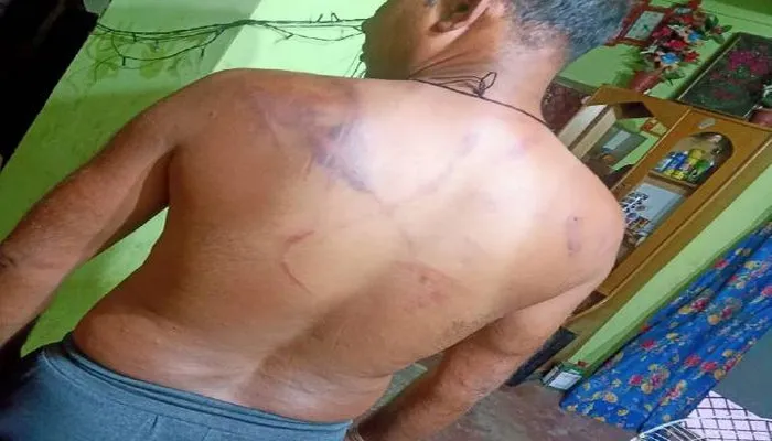 कानपुर: प्रधान पति ने दंपति को पीटा, महिला के कपड़े फाड़े, 19 लोगों पर केस दर्ज