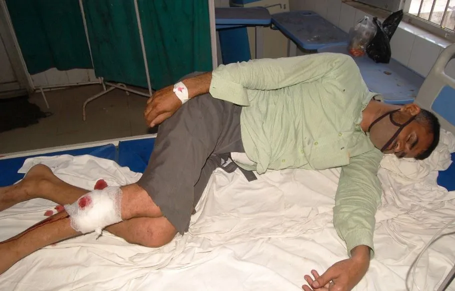 लखीमपुर खीरी: कई मामलों में फरार चल रहा इनामी बदमाश पुलिस के हत्थे चढ़ा, मुठभेड़ के बाद गिरफ्तार