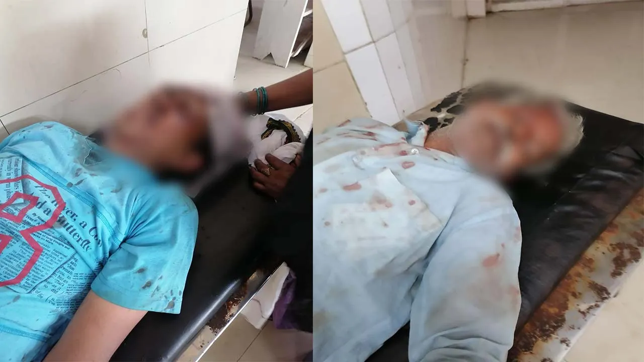 कुशीनगर: घर से निकले थे बकरी चराने, आधा दर्जन लोग पहुंच गए अस्पताल