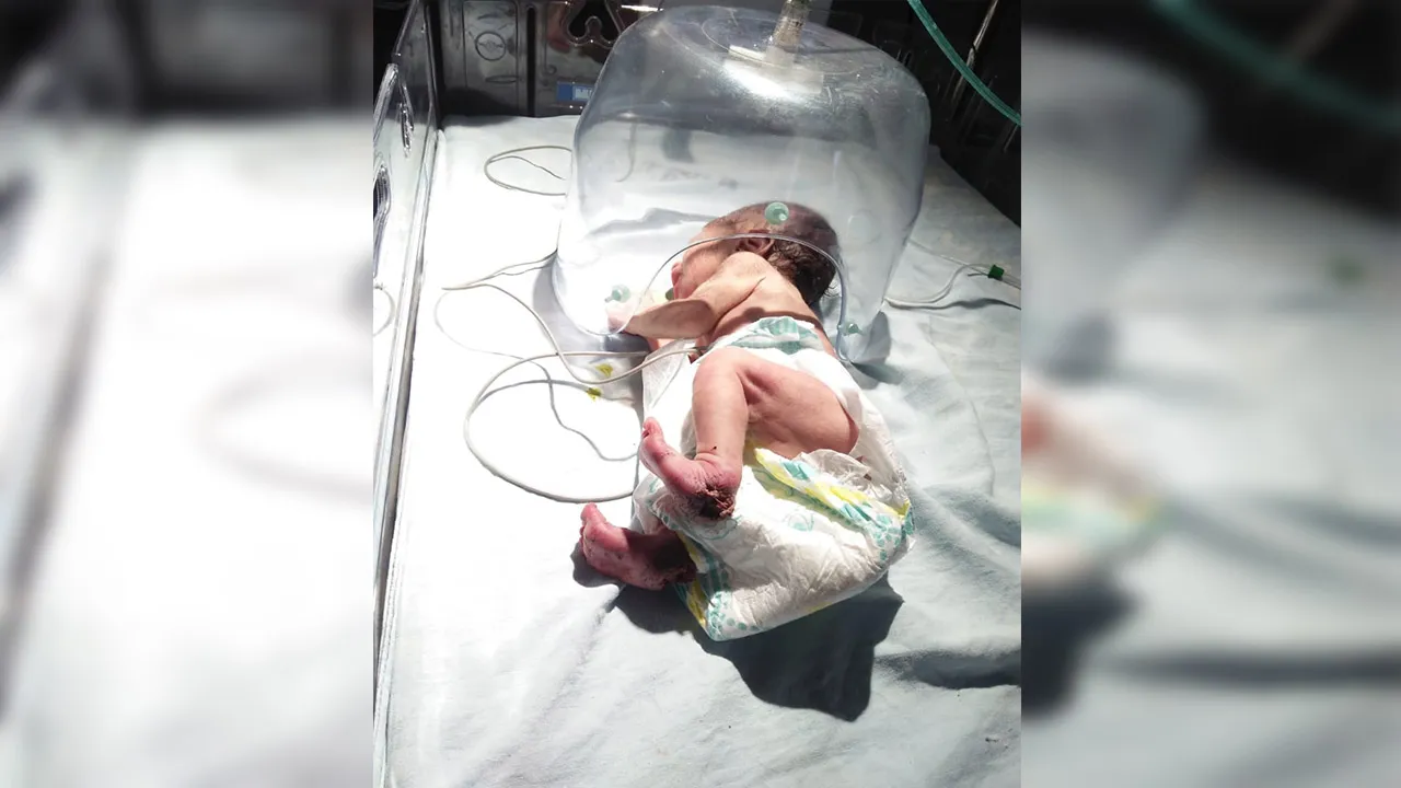 बरेली: जन्म के चंद घंटे के बाद नवजात बच्ची को गन्ने के खेत में फेंका, कीड़े खा गए दोनों पैर