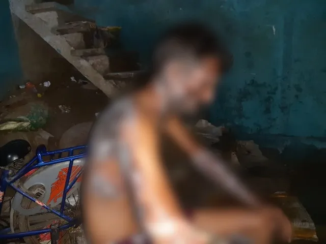 लखीमपुर खीरी: संपत्ति विवाद में भतीजों ने चाचा पर तेजाब फेंका, फिर पेट्रोल डालकर लगाई आग