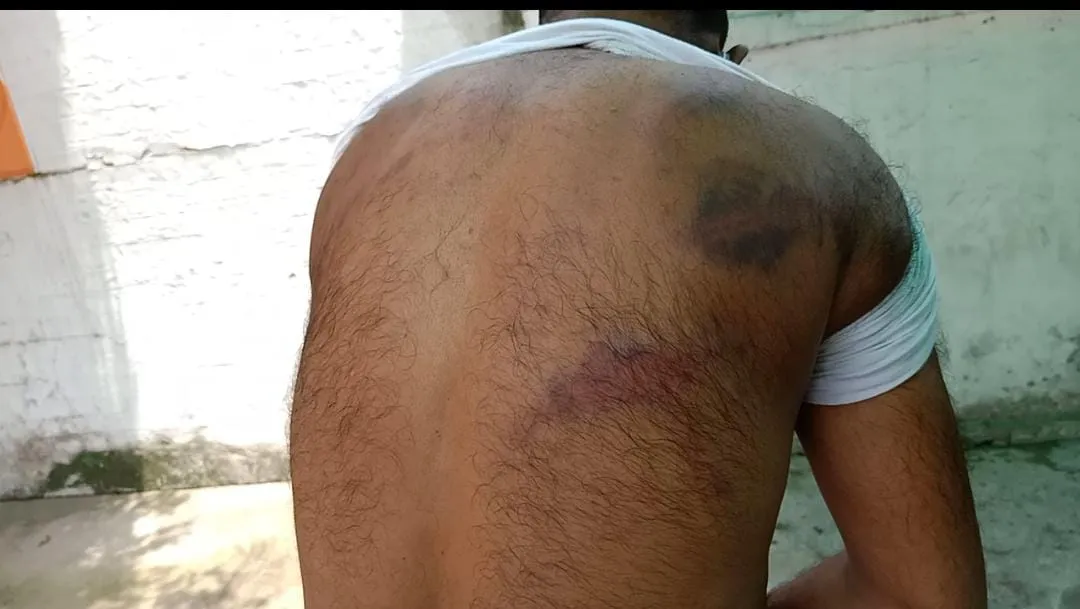 बरेली: प्रधान पति ने बंधक बनाकर युवकों को पीटा