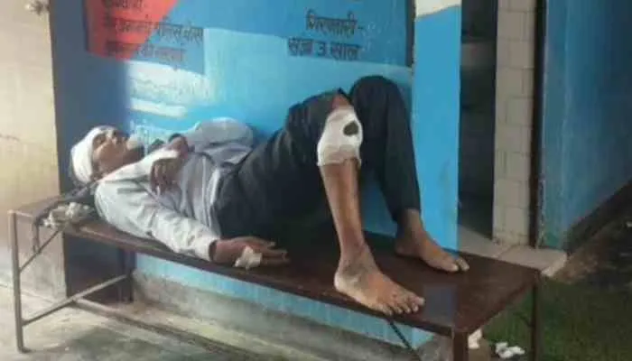 फतेहपुर: डीसीएम की टक्कर से बाइक सवार दंपति घायल, पुलिस ने कराया भर्ती