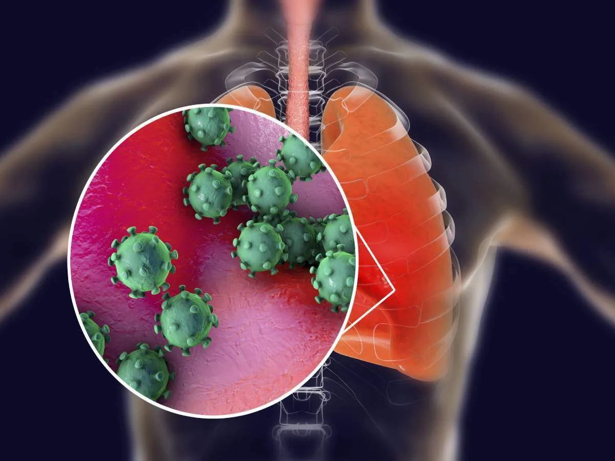 बरेली: कोरोना ने खराब किए फेफड़े, ट्रांसप्लांट ही बचा सकती है जिंदगी