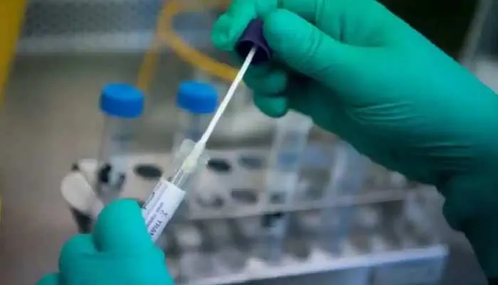बरेली: डॉक्टरों ने बनाया सुपर मास्टर प्लान… इस तहर होगी कोरोना की हार