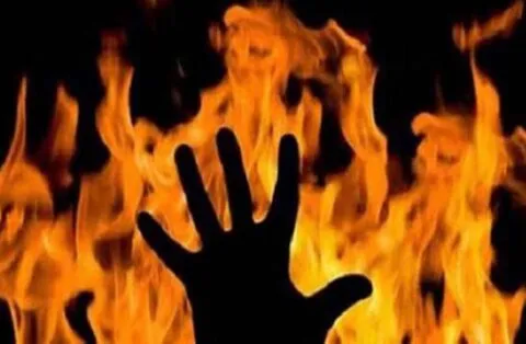 हल्द्वानी: बुजुर्ग ने घर के बाहर खुद पर केरोसिन डाल लगाई आग