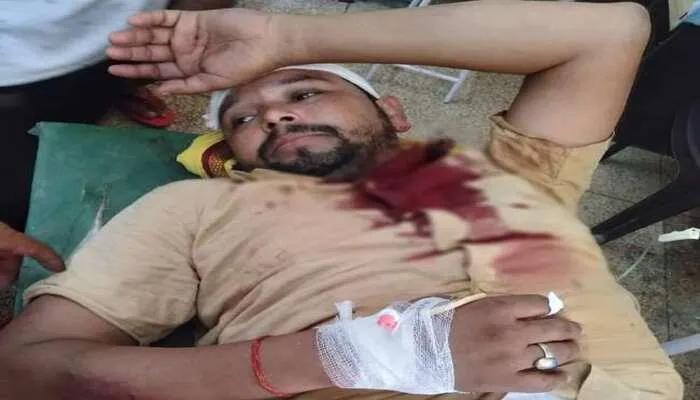 अमेठी: शिक्षक पर हुई ताबड़तोड़ फायरिंग, हमलावरों की तलाश में जुटी पुलिस