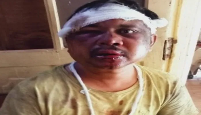 लखीमपुर: नशे में युवक ने घर में घुस कर की छेड़छाड़, पड़ोसियों ने की पिटाई
