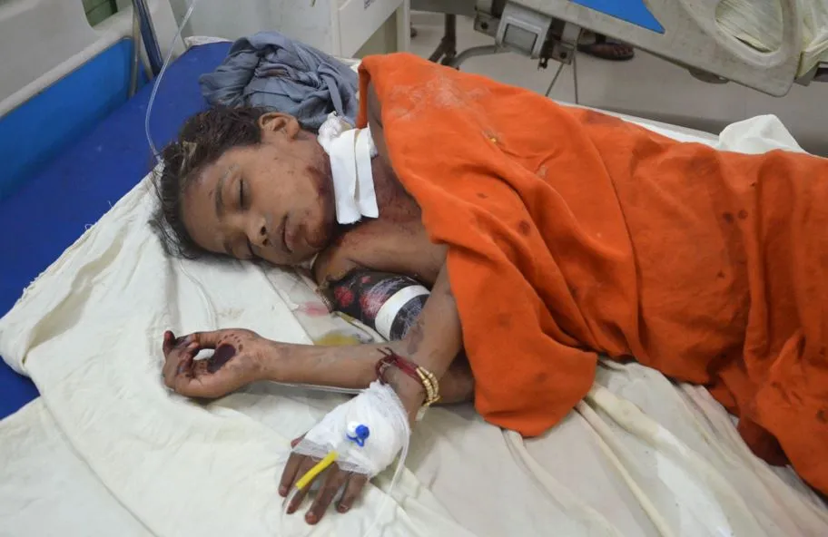 बरेली: कुत्तों के झुंड का बच्ची पर हमला, मांस नोचकर खाया