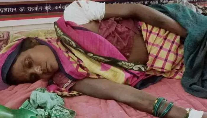 बहराइच: तेंदुए ने किया महिला पर हमला, अस्पताल में भर्ती
