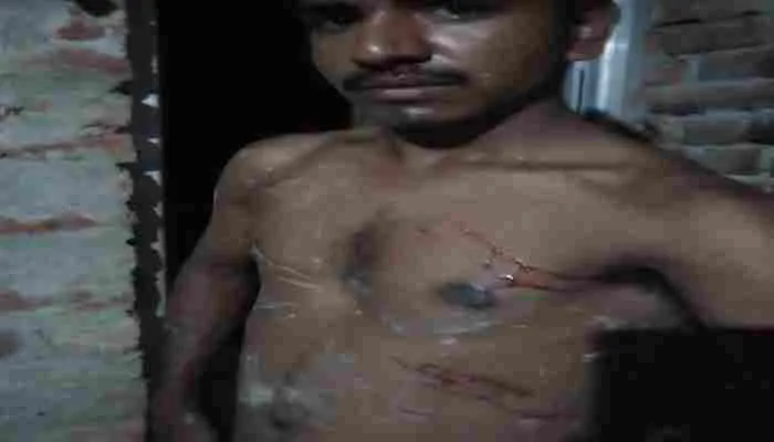 बाराबंकी: बेलगाम हुई असन्द्रा पुलिस! वर्दी के नशे में चूर दरोगा ने व्यापारी को कटीले तार से पीटा