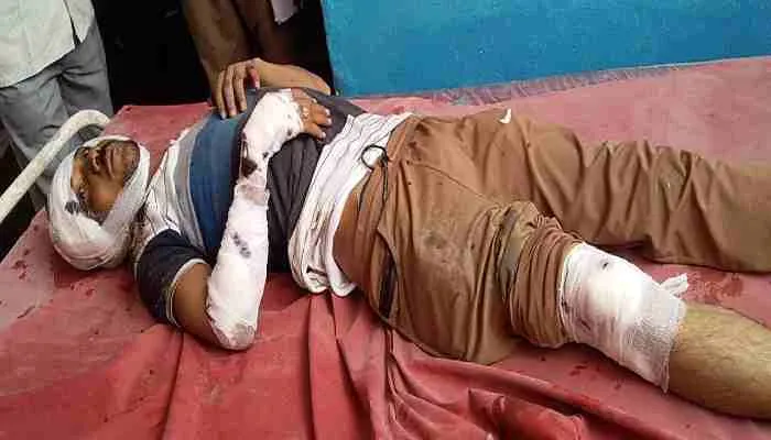 फतेहपुर: ट्रक की चपेट में आने से बाइक सवार गंभीर रूप से घायल
