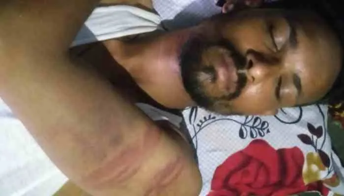 लखनऊ में फिर दिखा खाकी का अमानवीय चेहरा! ई-रिक्शा चालक पर बरपाया कहर