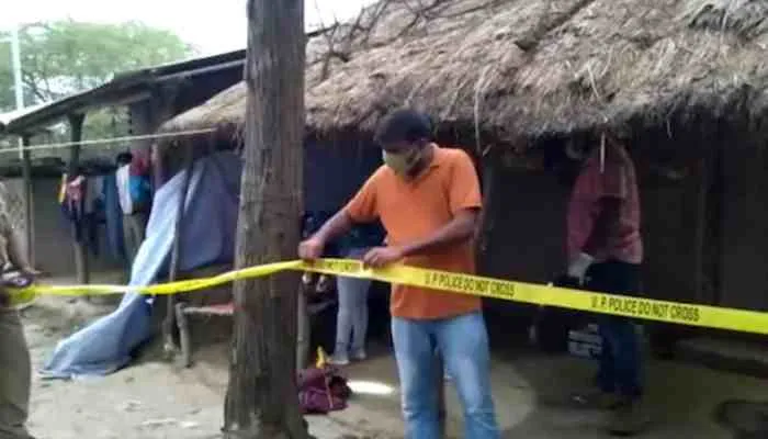 रायबरेली: भाई-बहन पर फेंका तेजाब, ट्रॉमा सेंटर रेफर, पुलिस ने किया ये दावा