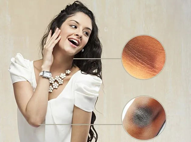 Home Remedies: गले, कोहनी और घुटनों के कालेपन से हैं परेशान, तो इन उपायों को अपनाकर दूर करें