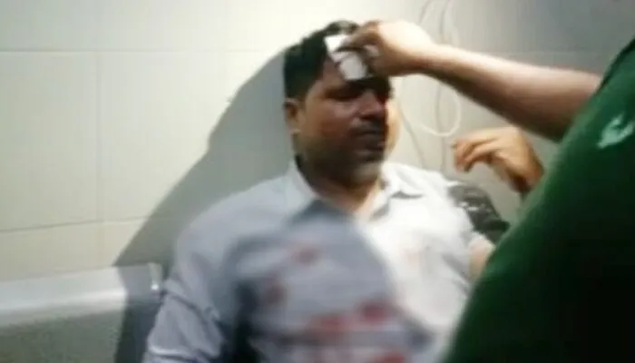 रायबरेली: सिपाही ने दीवान का कुर्सी से फोड़ा सिर, आरोपी निलंबित