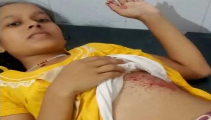 गोरखपुर: पुरानी रंजिश के चलते युवक ने चचेरी बहन को मारी गोली