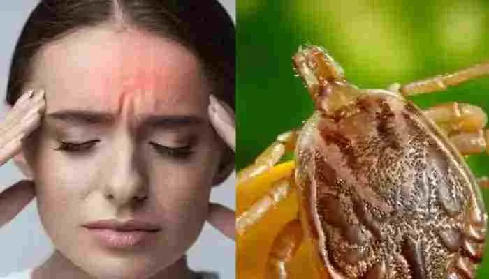 लखनऊ: डेंगू, मलेरिया के बाद अब स्क्रब टाइफस बुखार ने दी दस्तक, तीन मरीजों पुष्टि