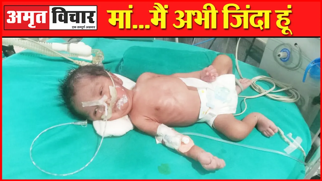 बरेली: निजी अस्पताल में नवजात को कर दिया मृत घोषित, जिला अस्पताल पहुंचे परिजन तो निकला जिंदा