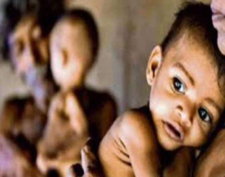 लखीमपुर-खीरी: बच्चों को कुपोषण से मुक्त करेगी संभव योजना