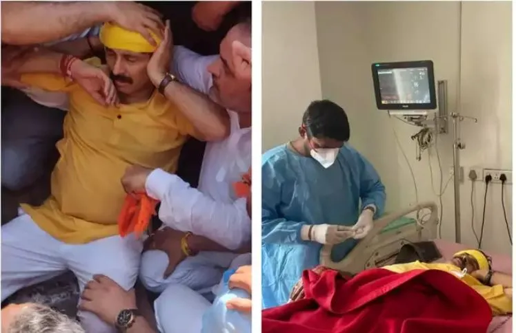 छठ पर बैन के खिलाफ केजरीवाल के घर के सामने प्रदर्शन में सांसद मनोज तिवारी हुए घायल