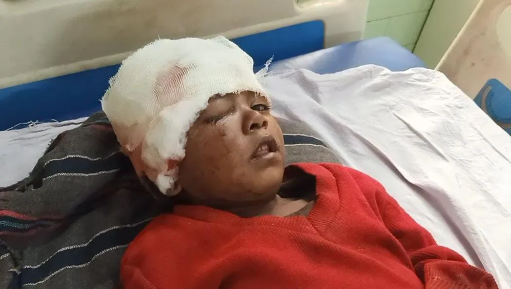 बरेली: घर से दुकान जा रहे मासूम पर कुत्तों का हमला, हालत गंभीर