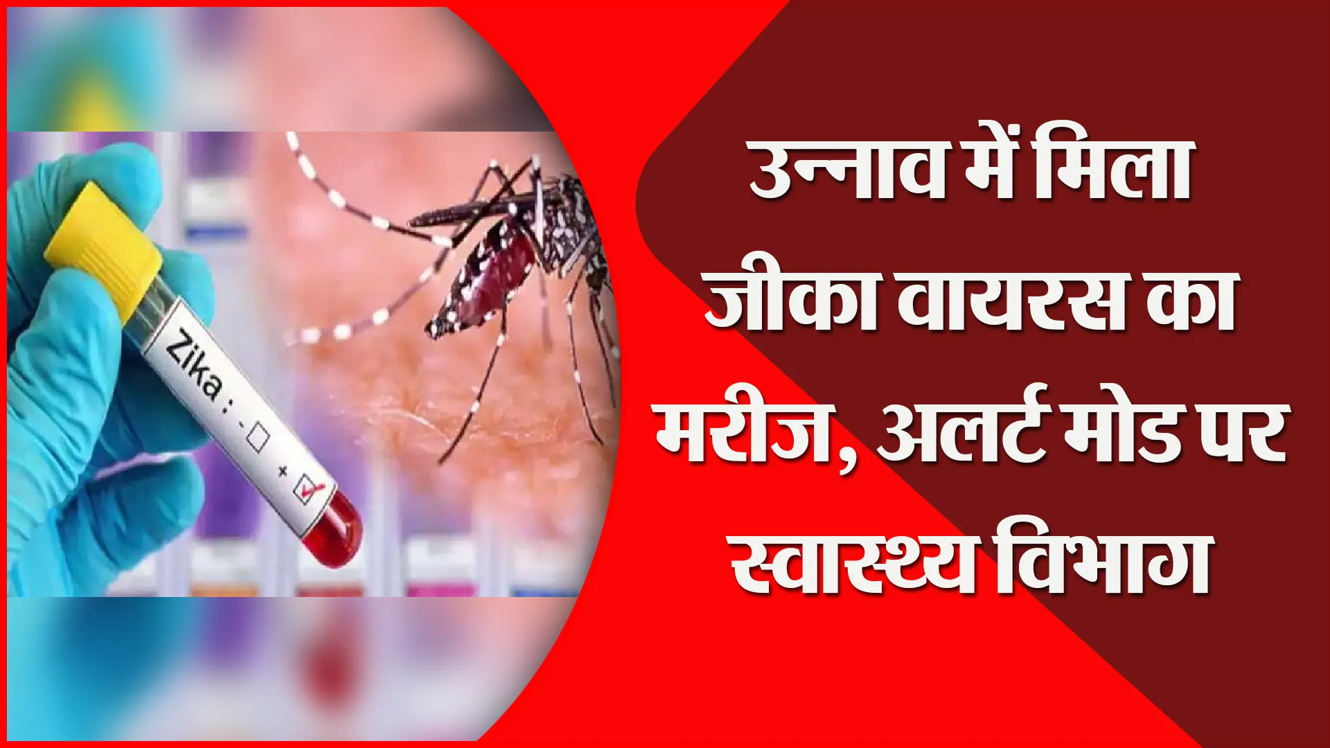उन्नाव में मिला जीका वायरस का मरीज, अलर्ट मोड पर स्वास्थ्य विभाग