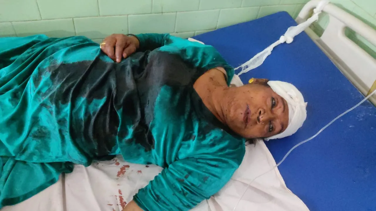 बरेली: ग्रीन पार्क में किन्नरों के दो गुटों में मारपीट, बांका लगने से एक घायल