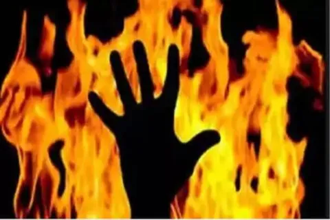 हल्द्वानी: गश खाकर चूल्हे पर गिरी महिला की झुलसकर मौत