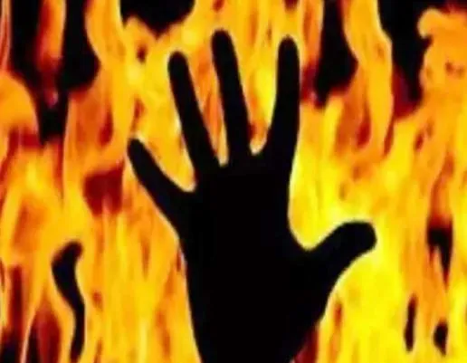 मुरादाबाद: ट्रिपल राइडिंग पर चालान से खफा युवक ने किया आत्मदाह का प्रयास