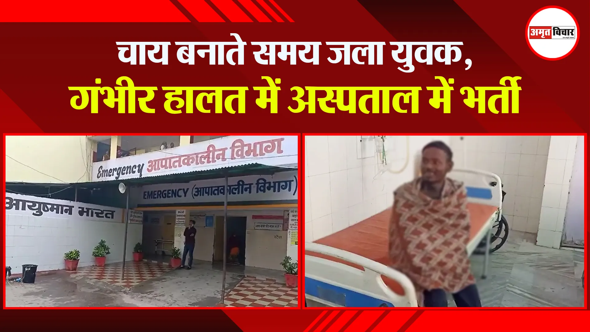बरेली: चाय बनाते समय जला युवक, गंभीर हालत में अस्पताल में भर्ती