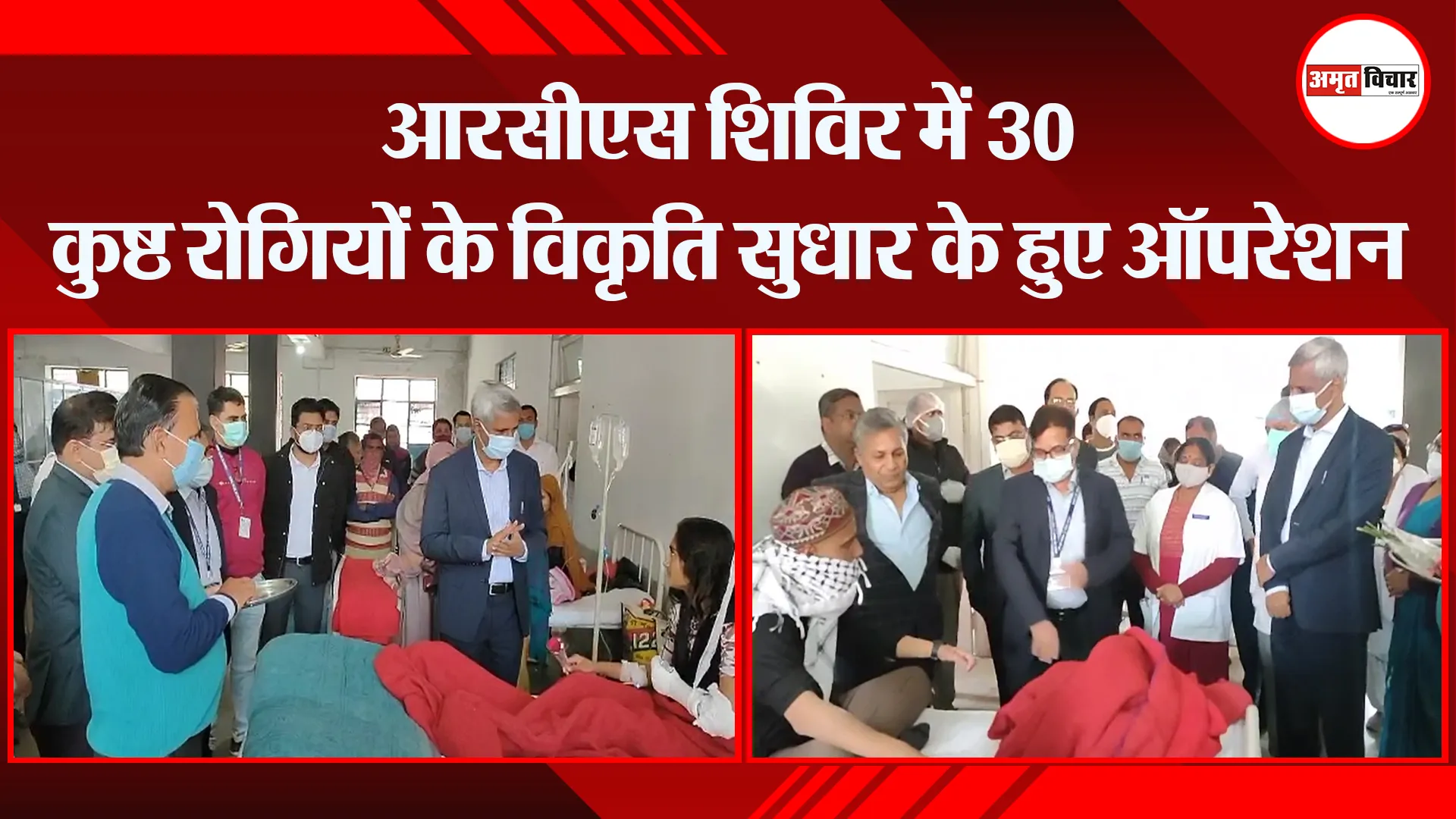 मुरादाबाद: आरसीएस शिविर में 30 कुष्ठ रोगियों के विकृति सुधार के हुए ऑपरेशन