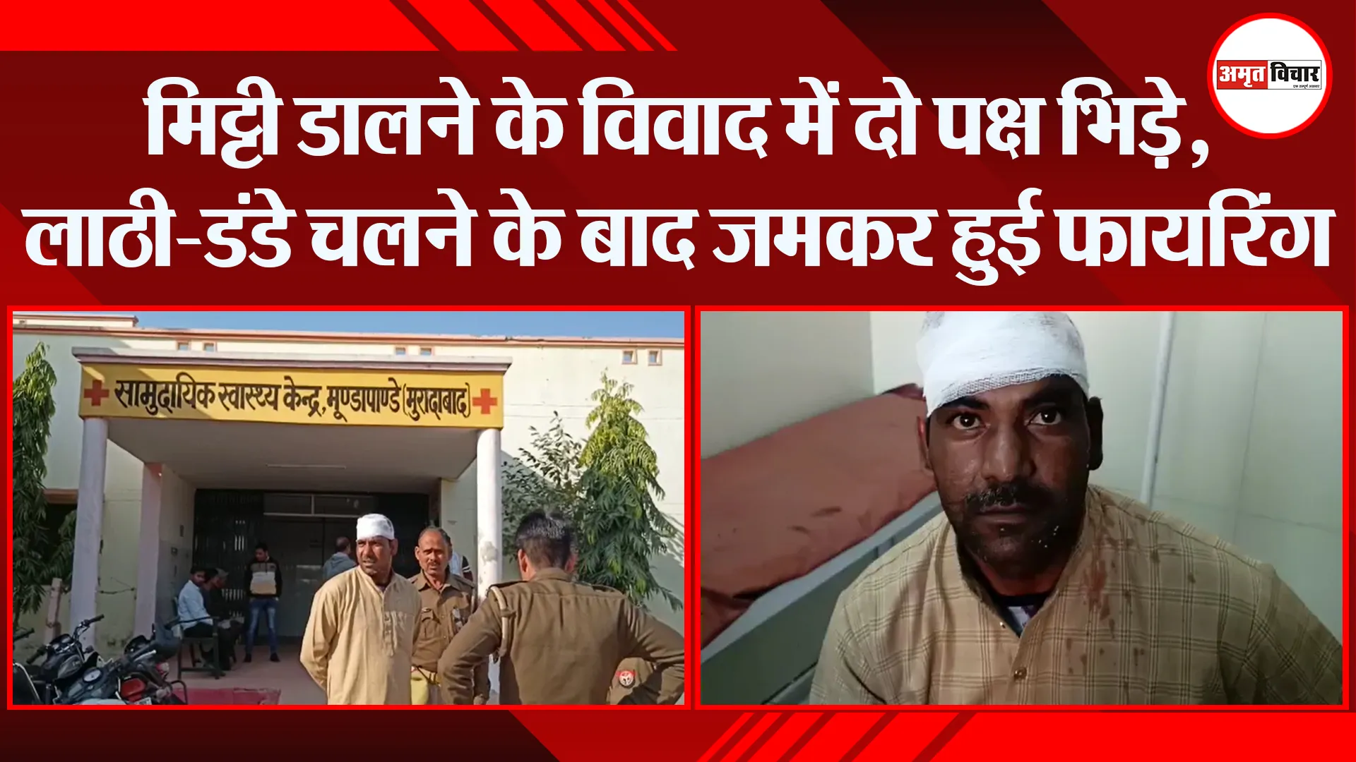 मुरादाबाद: मिट्टी डालने के विवाद में दो पक्ष भिड़े, लाठी-डंडे चलने के बाद जमकर हुई फायरिंग