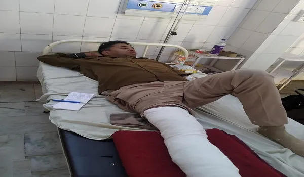 मुरादाबाद : कार की टक्कर से सिपाही घायल, पैर फ्रेक्चर