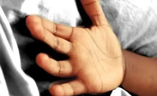 बरेली: बच्चे की मौत प्रकरण में दो अधिकारी निलंबित, प्रधान पर एफआईआर के निर्देश