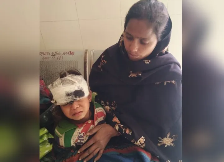 पीलीभीत: बुजुर्ग की जान लेने के बाद अब आवारा कुत्तों ने चार साल की बच्ची पर बोला हमला