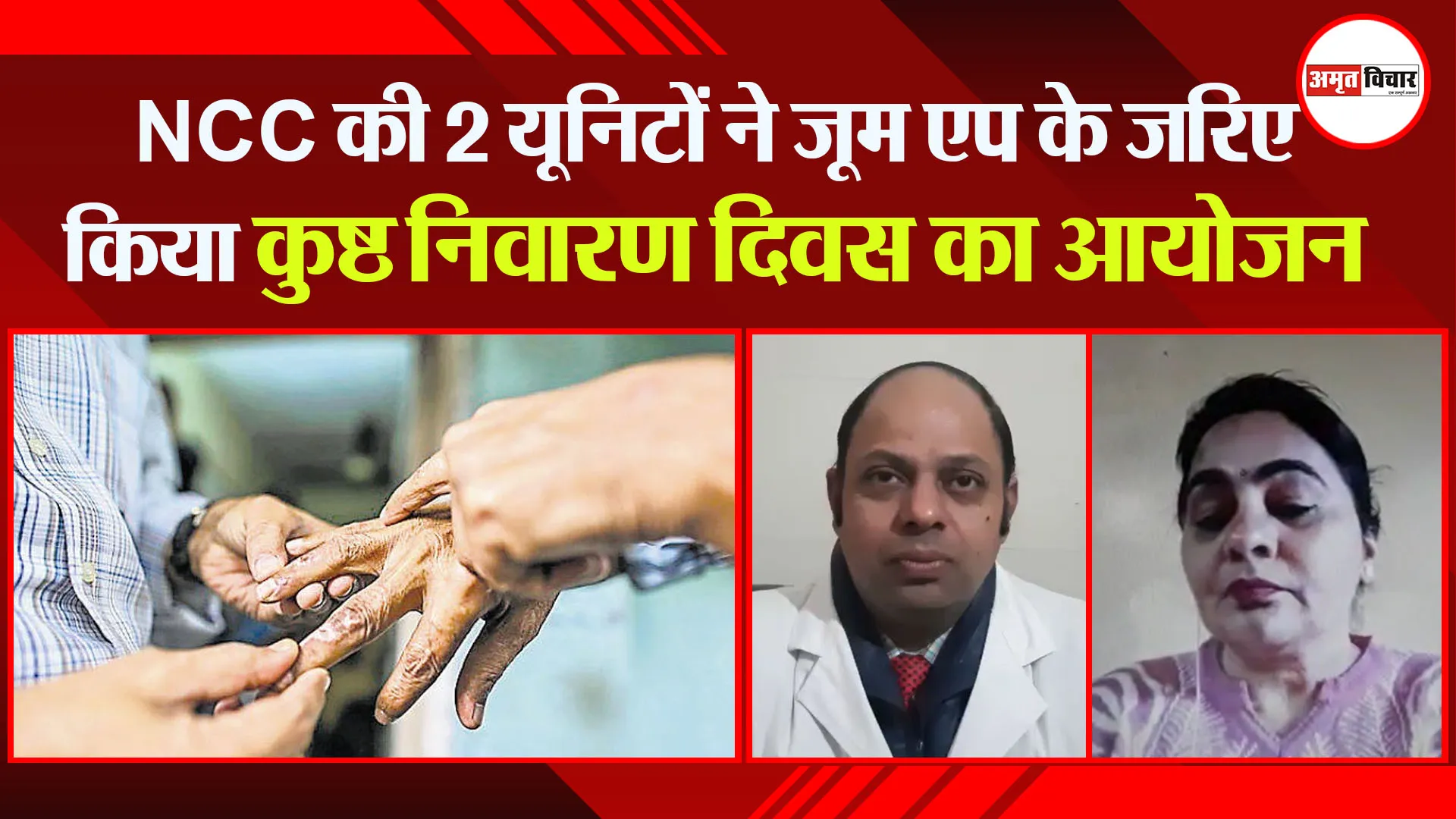 मुरादाबाद: NCC की 2 यूनिटों ने जूम एप के जरिए किया कुष्ठ निवारण दिवस का आयोजन