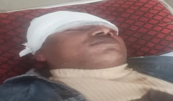 मुरादाबाद : भतीजे के साले ने मजदूर पर किया कुल्हाड़ी से हमला