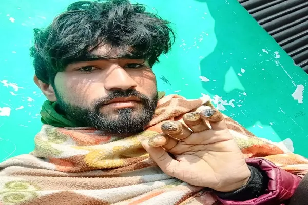 मुरादाबाद : ओवरटाइम करने से इनकार किया तो मजदूर की उंगलियां काटीं, दी जान से मारने की धमकी